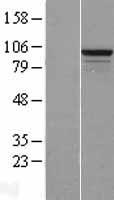 RSBN1L Human Over-expression Lysates NM_198467