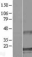 ATXN7L1 Human Over-expression Lysates NM_152749
