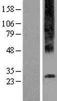 ls222487 gpr97 adgrg3 human over expression lysates nm 170776 wb testing 1
