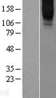 GPRC6A Human Over-expression Lysates NM_148963