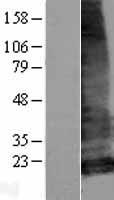ls222662 lhfpl5 human over expression lysates nm 182548 wb testing 1