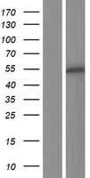 ls222696 zscan23 human over expression lysates nm 001012455 wb testing 1