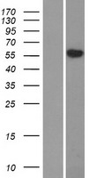SLC29A4 Human Over-expression Lysates NM_001040661