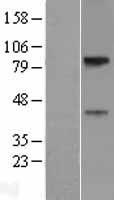 SLC29A4 Human Over-expression Lysates NM_153247