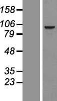 RSPH10B Human Over-expression Lysates NM_173565