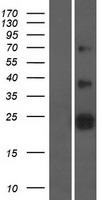 ZNRF2 Human Over-expression Lysates NM_147128