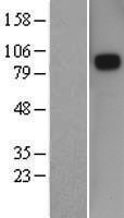 Semaphorin 3D (SEMA3D) Human Over-expression Lysates NM_152754