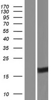 VGLL2 Human Over-expression Lysates NM_153453
