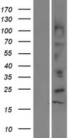 ls245915 defb112 human over expression lysates nm 001037498 wb testing 1