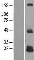 DEFB125 Human Over-expression Lysates NM_153325