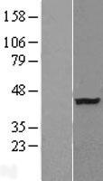 ATP6V0D2 Human Over-expression Lysates NM_152565