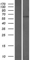 CNO6L (CNOT6L) Human Over-expression Lysates NM_144571