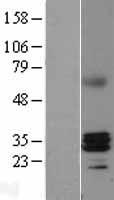 RNase H1 (RNASEH1) Human Over-expression Lysates NM_002936