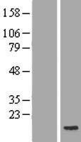 POLR2J2 Human Over-expression Lysates NM_032959