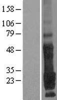 TMEM9 Human Over-expression Lysates NM_016456
