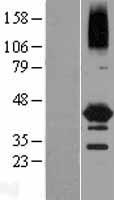 NEIL2 Human Over-expression Lysates NM_145043