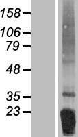 FNDC5 Human Over-expression Lysates NM_153756