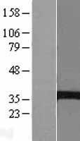 ABHD7 (EPHX4) Human Over-expression Lysates NM_173567