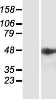 IPMK Human Over-expression Lysates NM_152230