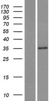 SLC25A30 Human Over-expression Lysates NM_001010875