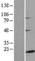 ls253827 msrb3 human over expression lysates nm 198080 wb testing 1