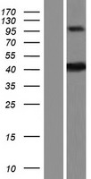 ZDHHC20 Human Over-expression Lysates NM_153251