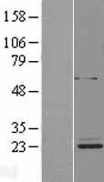 ls254013 etfbkmt human over expression lysates nm 173802 wb testing 1