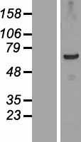 ls254187 tsga10ip human over expression lysates nm 152762 wb testing 1
