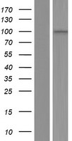 ls254268 aknad1 human over expression lysates nm 152763 wb testing 1
