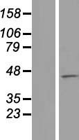 MCM9 Human Over-expression Lysates NM_153255
