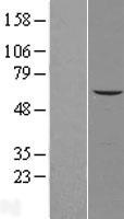 ls254531 agpat7 lpcat4 human over expression lysates nm 153613 wb testing 1