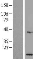 MPV17L Human Over-expression Lysates NM_173803