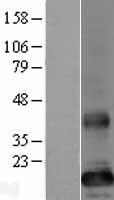 ls255043 tmem86b human over expression lysates nm 173804 wb testing 1