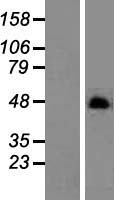 DOS (CBARP) Human Over-expression Lysates NM_152769