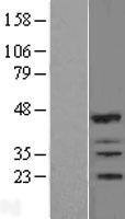 IBRDC2 (RNF144B) Human Over-expression Lysates NM_182757