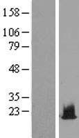 H2BC1 Human Over-expression Lysates NM_170610