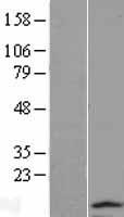 ls255758 tctex1d2 human over expression lysates nm 152773 wb testing 1