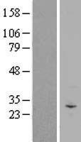 C3orf43 (SMCO1) Human Over-expression Lysates NM_001077657