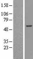 BCL6B Human Over-expression Lysates NM_181844