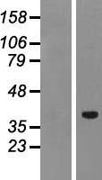 PTF1A Human Over-expression Lysates NM_178161