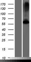 GK5 Human Over-expression Lysates NM_001039547