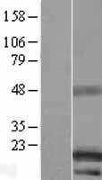ls256369 c14orf48 linc00521 human over expression lysates nm 152777 wb testing 1