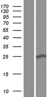 ST6GALNAC3 Human Over-expression Lysates NM_001160011