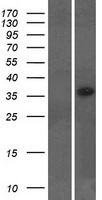LYSMD2 Human Over-expression Lysates NM_153374