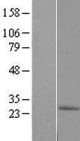 ls256815 c10orf67 human over expression lysates nm 153714 wb testing 1
