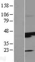 SUNC1 (SUN3) Human Over-expression Lysates NM_152782