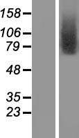 TMEM146 (CATSPERD) Human Over-expression Lysates NM_152784