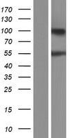 ARHGAP30 Human Over-expression Lysates NM_181720