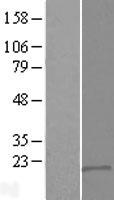 DSCR9 Human Over-expression Lysates NM_148675
