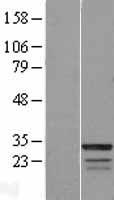 FAM133B Human Over-expression Lysates NM_001040057